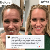 Synergy® | Collagen Sleep Mask