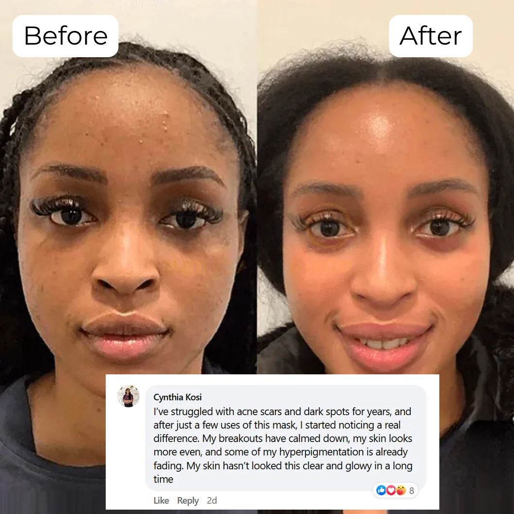 Synergy® | Collagen Sleep Mask